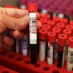 Ransomware Gang Collects Data from Blood Testing Lab